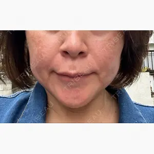 湘南美容クリニック 横浜院口コミ