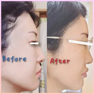 BIANCA銀座口コミ