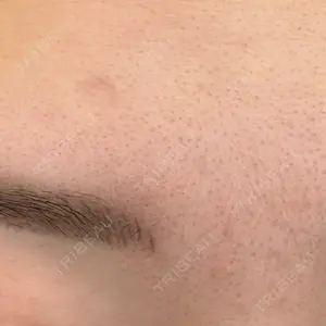 三鷹はなふさ皮膚科口コミ