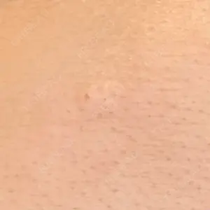 三鷹はなふさ皮膚科口コミ