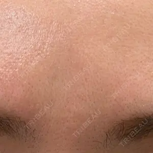 品川スキンクリニック広島院口コミ