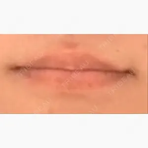 Mavie Beauty Clinic （マヴィービューティークリニック）口コミ