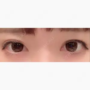 ジュエリー美容外科口コミ