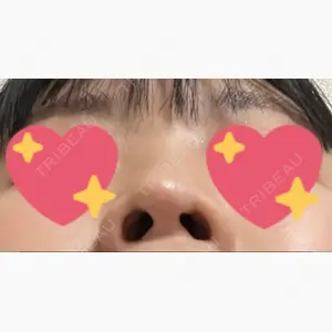 Zetith Beauty Clinic 銀座院口コミ