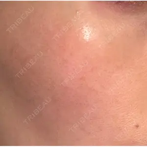 美容皮膚科エルムクリニック 広島院口コミ