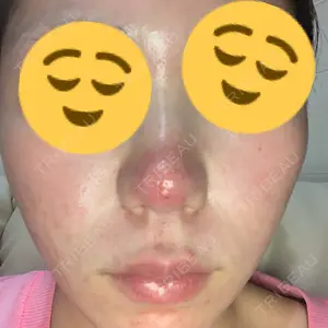 レナータクリニック 立川院口コミ