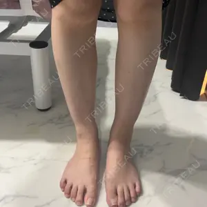 L‘amour clinic Tokyo【ラムールクリニック東京】口コミ
