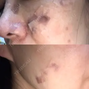 ノリス美容クリニック口コミ