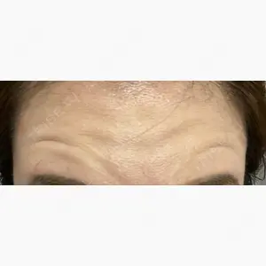 湘南美容クリニック 八王子院口コミ