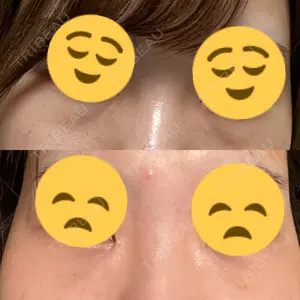 東京イセアクリニック口コミ