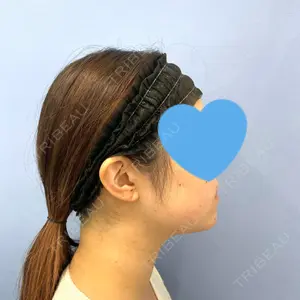 湘南美容クリニック 秋葉原院口コミ