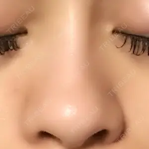 湘南美容クリニック 新宿本院口コミ
