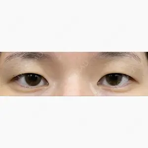 東京イセアクリニック口コミ
