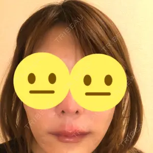 銀座ゼロクリニック口コミ
