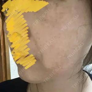 Wi Clinic（ウィ クリニック） 大宮院口コミ