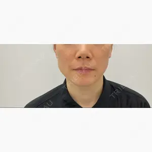 東郷美容形成外科 福岡口コミ