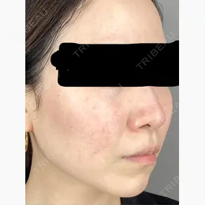 東京美容クリニック 表参道本院口コミ
