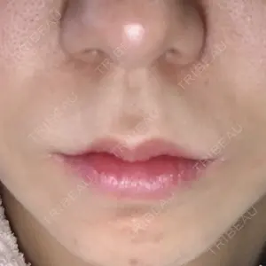 清潭女神美容外科口コミ