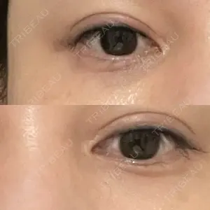 有楽町美容外科クリニック口コミ
