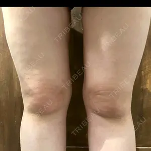 Anterior 大阪梅田院口コミ