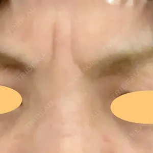 品川スキンクリニック立川院口コミ