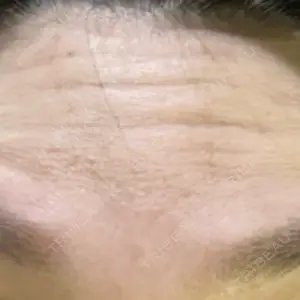 湘南美容クリニック 広島院口コミ