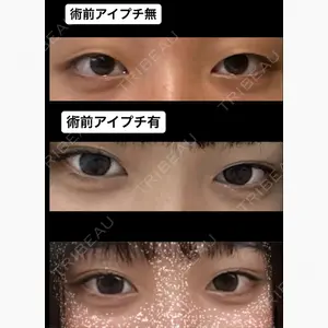 水の森美容クリニック 大阪梅田院口コミ