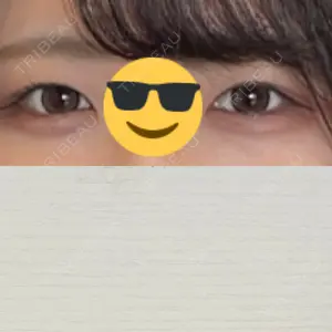 東京イセアクリニック口コミ