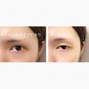大阪梅田中央クリニック美容外科口コミ