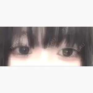 水の森美容クリニック 大阪梅田院口コミ