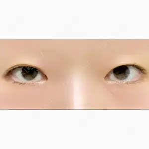 神戸元町ビューティークリニック口コミ