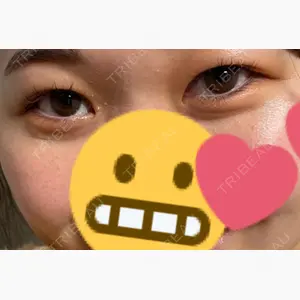 ハニークリニック口コミ