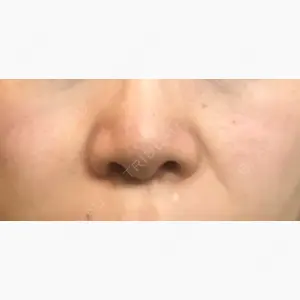 ビューティースキンクリニック 新宿院口コミ