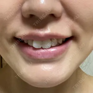 X CLINIC 銀座院口コミ