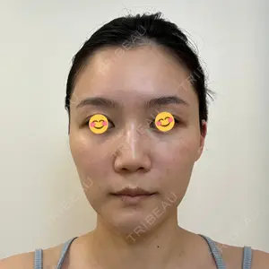 スキンリファインクリニック銀座口コミ