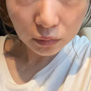 あつぎ美容クリニック口コミ