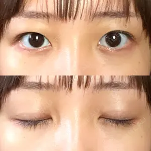 藤井美容外科口コミ