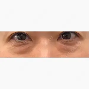 東京イセアクリニック口コミ