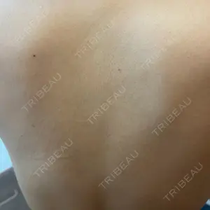 美容皮膚科エルムクリニック 福岡院口コミ