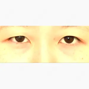 札幌ル・トロワ ビューティクリニックVogue口コミ