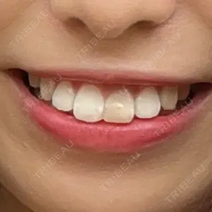 オーラルビューティークリニック クラリス審美歯科・矯正歯科口コミ