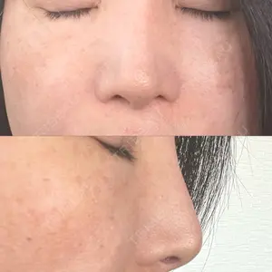 聖心美容クリニック 大阪院口コミ