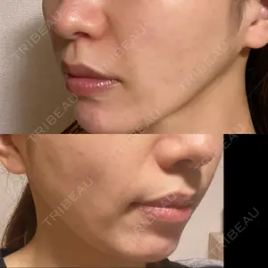 イテウォンビューティークリニック 名古屋栄院口コミ