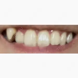 東京国際歯科 六本木口コミ