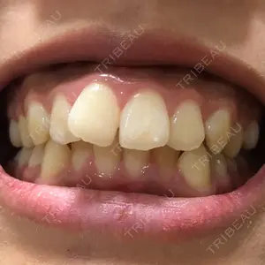 クールホワイトデンタルクリニック口コミ