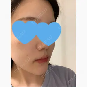 イテウォンビューティークリニック 名古屋栄院口コミ