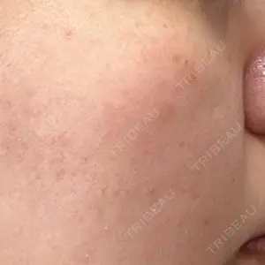 メディスリールクリニック口コミ