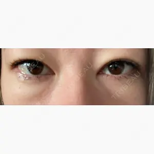 湘南美容クリニック 池袋東口院口コミ