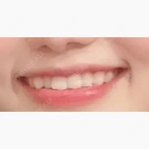 スマイルプランさくら歯科クリニック口コミ