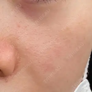NEW FACE AESTHETIC CLINIC 新宿院口コミ